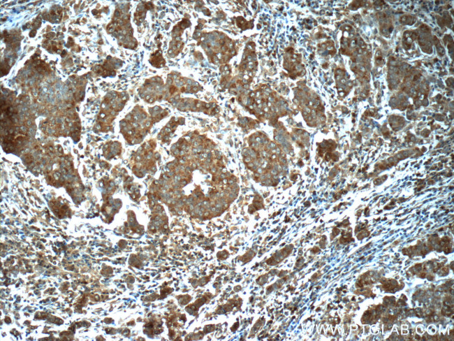 VPRBP Antibody in Immunohistochemistry (Paraffin) (IHC (P))