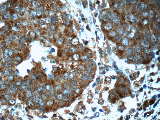 VPRBP Antibody in Immunohistochemistry (Paraffin) (IHC (P))