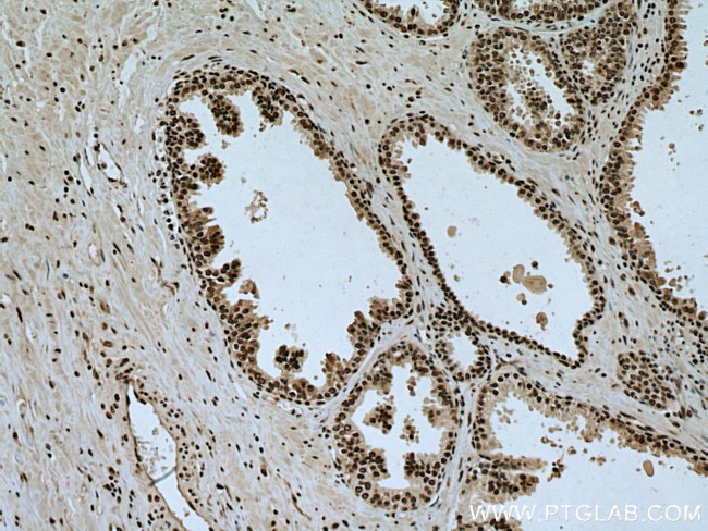 VPRBP Antibody in Immunohistochemistry (Paraffin) (IHC (P))