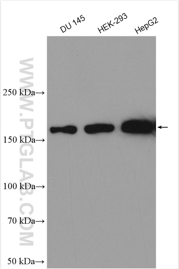 VPRBP Antibody in Western Blot (WB)