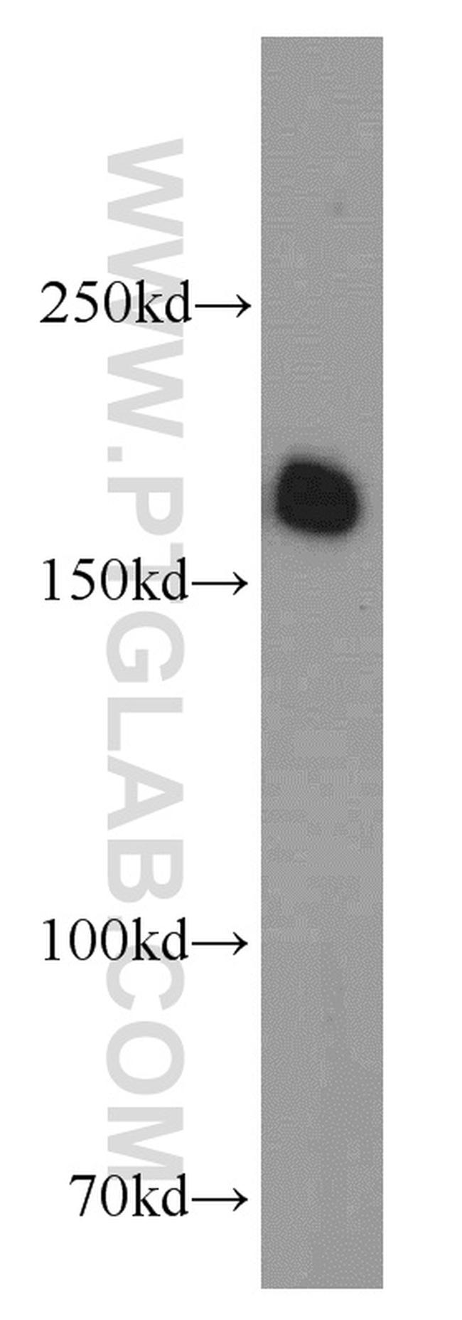 VPRBP Antibody in Western Blot (WB)