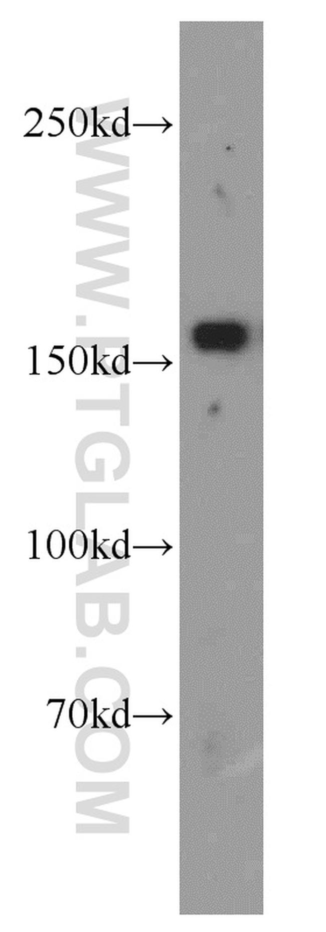 VPRBP Antibody in Western Blot (WB)