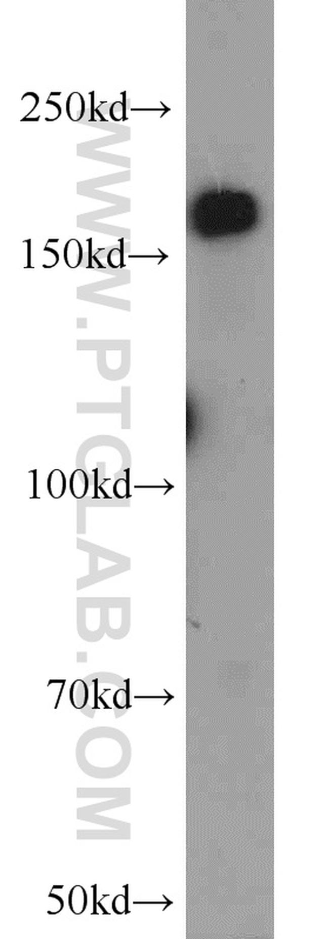 VPRBP Antibody in Western Blot (WB)