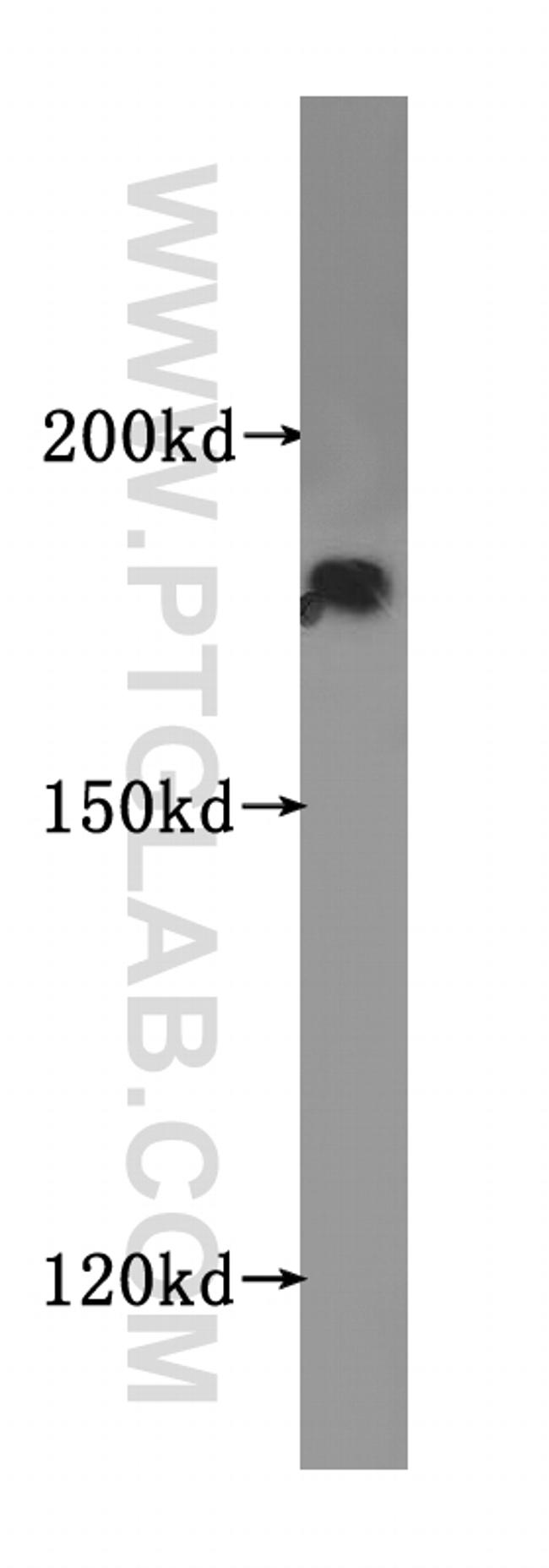 VPRBP Antibody in Western Blot (WB)