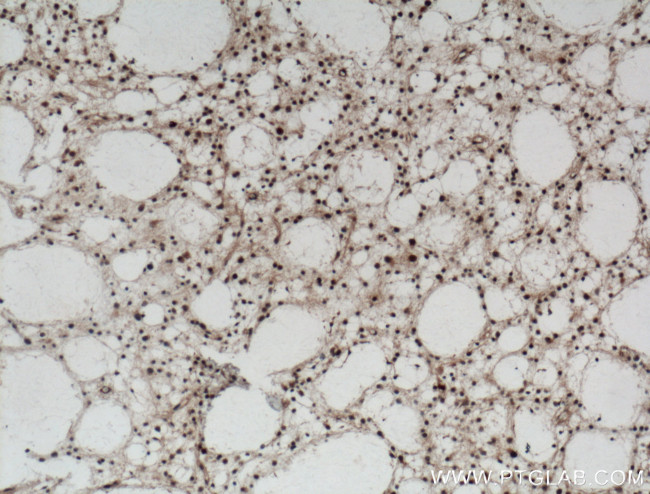 BCL11A Antibody in Immunohistochemistry (Paraffin) (IHC (P))