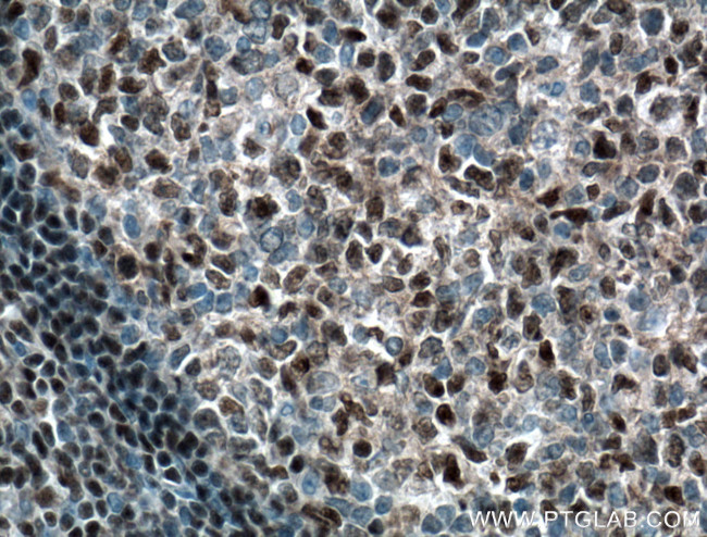 BCL11A Antibody in Immunohistochemistry (Paraffin) (IHC (P))