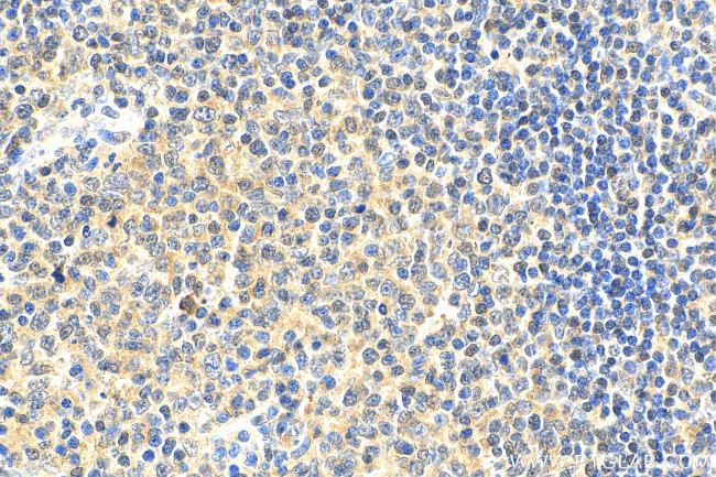 BCL11A Antibody in Immunohistochemistry (Paraffin) (IHC (P))