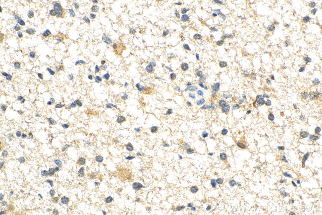 BCL11A Antibody in Immunohistochemistry (Paraffin) (IHC (P))