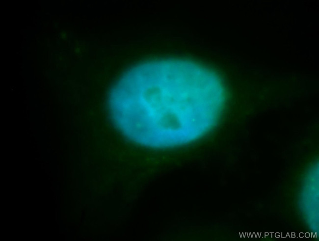 RBM4 Antibody in Immunocytochemistry (ICC/IF)