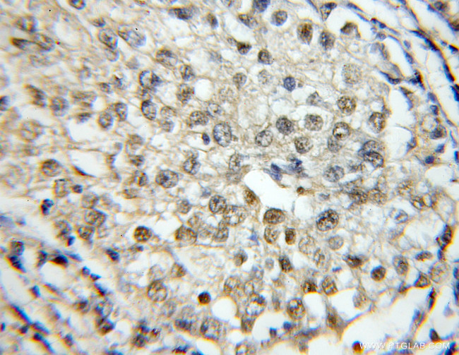 RBM4 Antibody in Immunohistochemistry (Paraffin) (IHC (P))