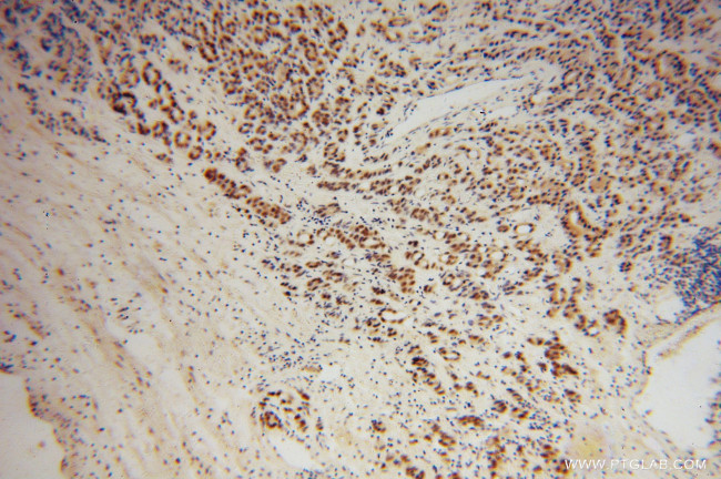 RBM4 Antibody in Immunohistochemistry (Paraffin) (IHC (P))