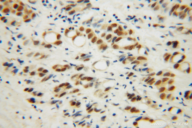 RBM4 Antibody in Immunohistochemistry (Paraffin) (IHC (P))