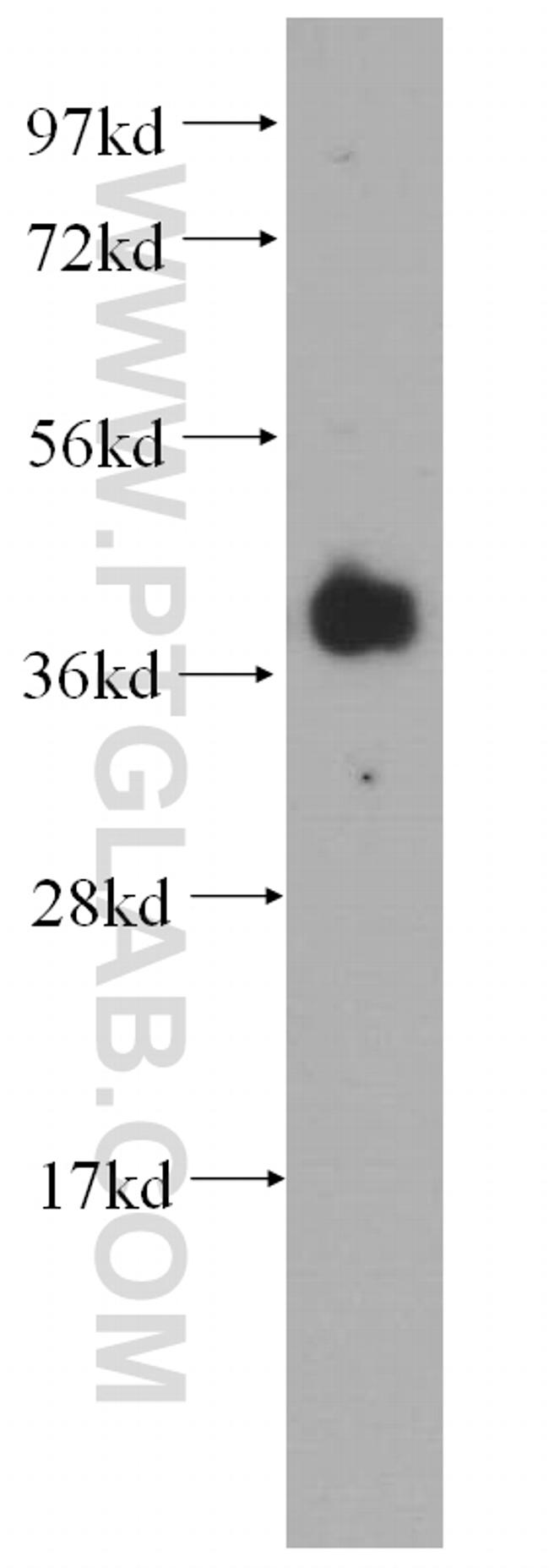 RBM4 Antibody in Western Blot (WB)