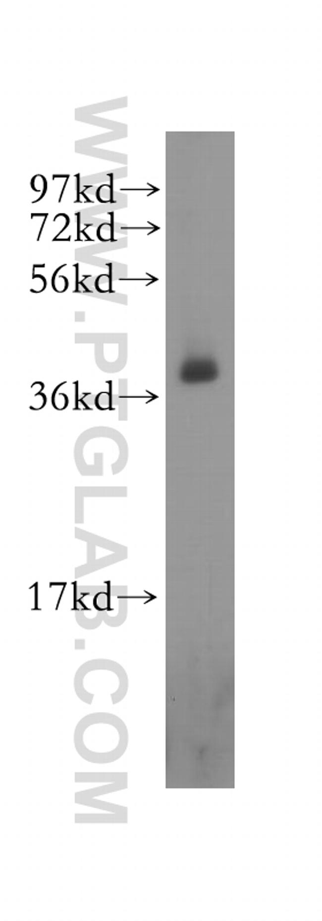 RBM4 Antibody in Western Blot (WB)