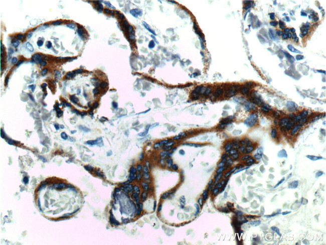 hCG beta Antibody in Immunohistochemistry (Paraffin) (IHC (P))