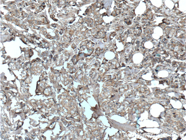 hCG beta Antibody in Immunohistochemistry (Paraffin) (IHC (P))