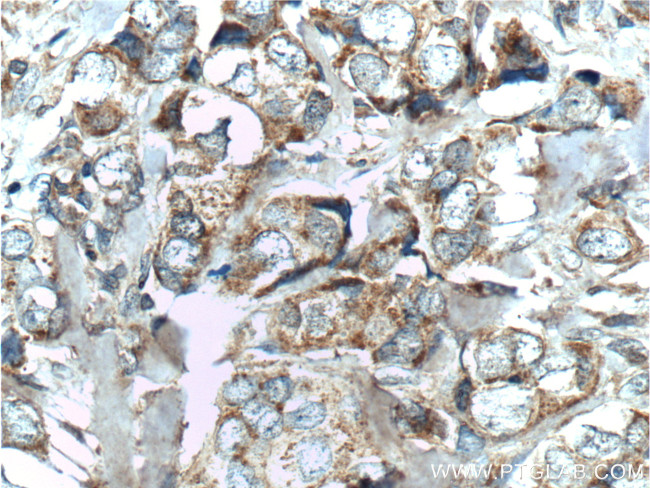 hCG beta Antibody in Immunohistochemistry (Paraffin) (IHC (P))