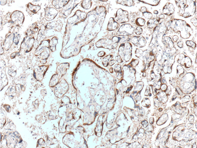 hCG beta Antibody in Immunohistochemistry (Paraffin) (IHC (P))