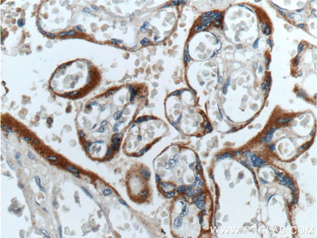 hCG beta Antibody in Immunohistochemistry (Paraffin) (IHC (P))