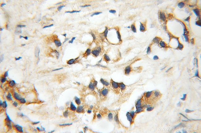 DDX28 Antibody in Immunohistochemistry (Paraffin) (IHC (P))