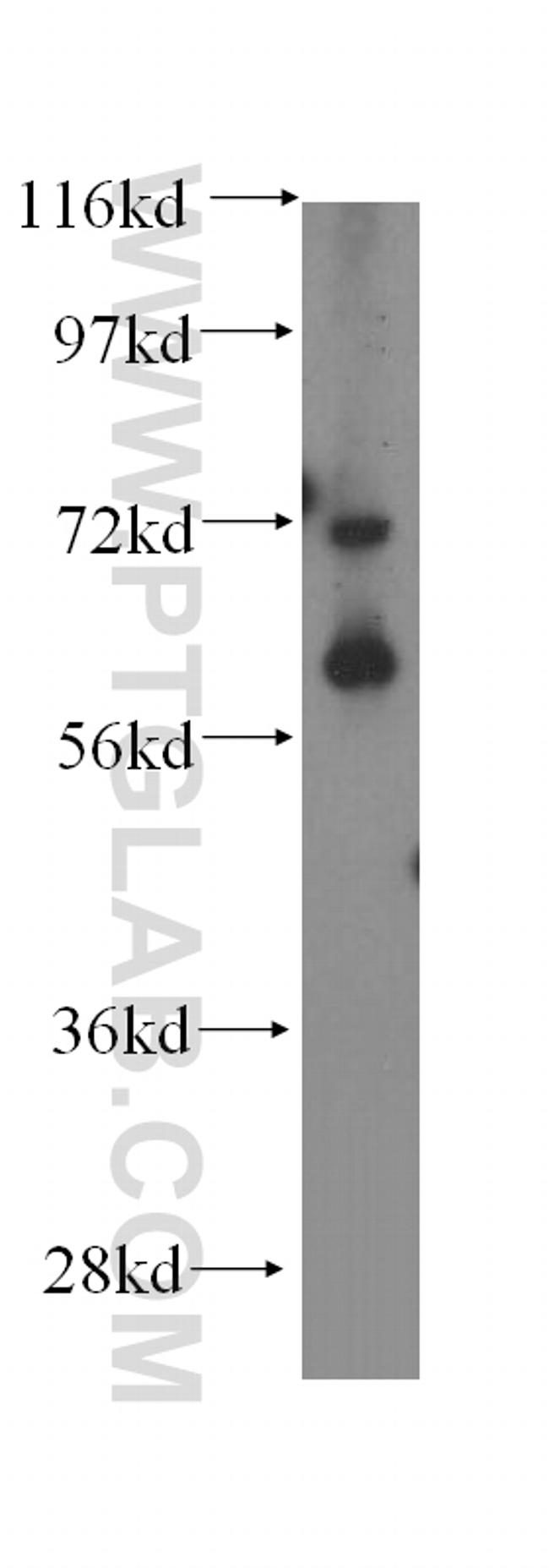 DDX28 Antibody in Western Blot (WB)