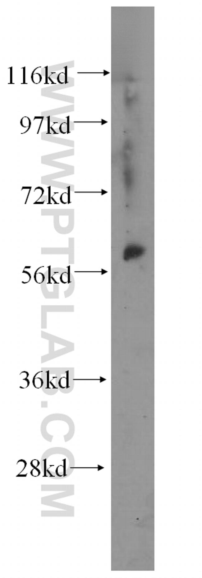 DDX28 Antibody in Western Blot (WB)