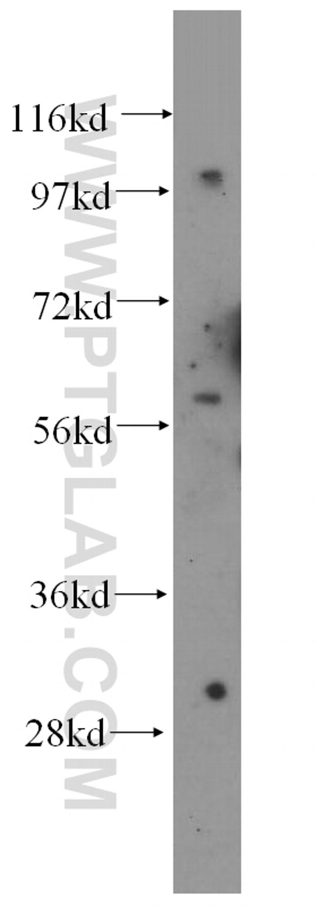 DDX28 Antibody in Western Blot (WB)