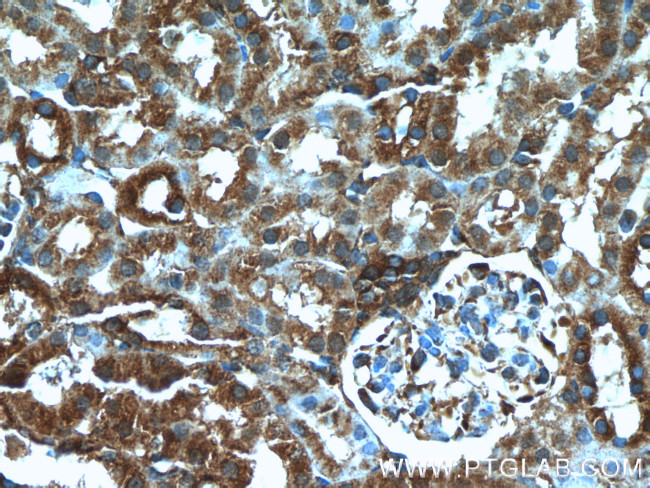 DOCK8 Antibody in Immunohistochemistry (Paraffin) (IHC (P))