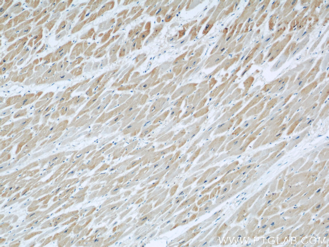 DOCK8 Antibody in Immunohistochemistry (Paraffin) (IHC (P))