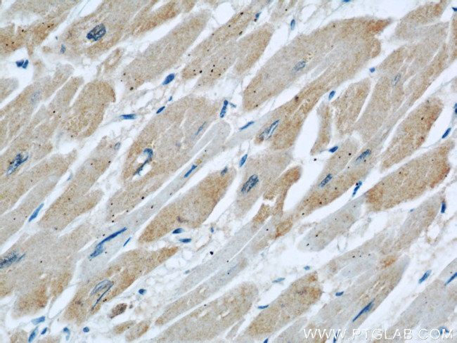 DOCK8 Antibody in Immunohistochemistry (Paraffin) (IHC (P))