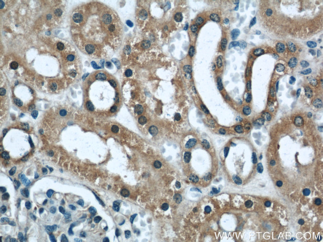 DOCK8 Antibody in Immunohistochemistry (Paraffin) (IHC (P))