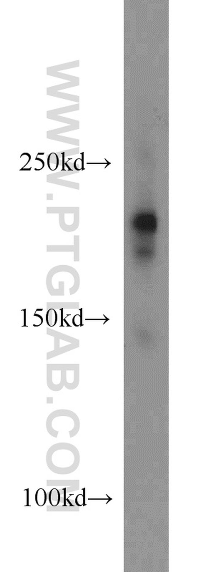 DOCK8 Antibody in Western Blot (WB)