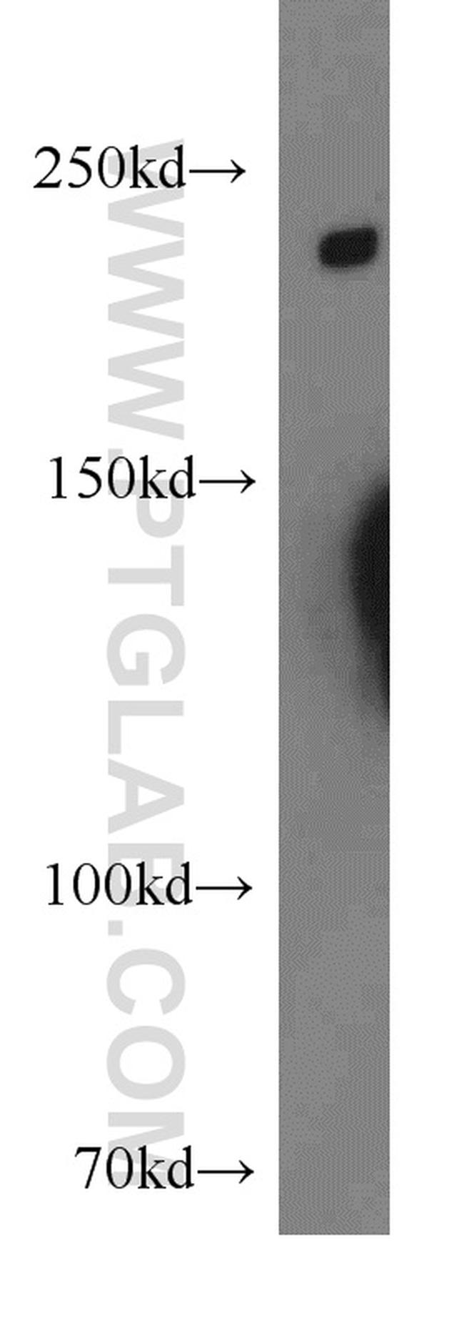 DOCK8 Antibody in Western Blot (WB)