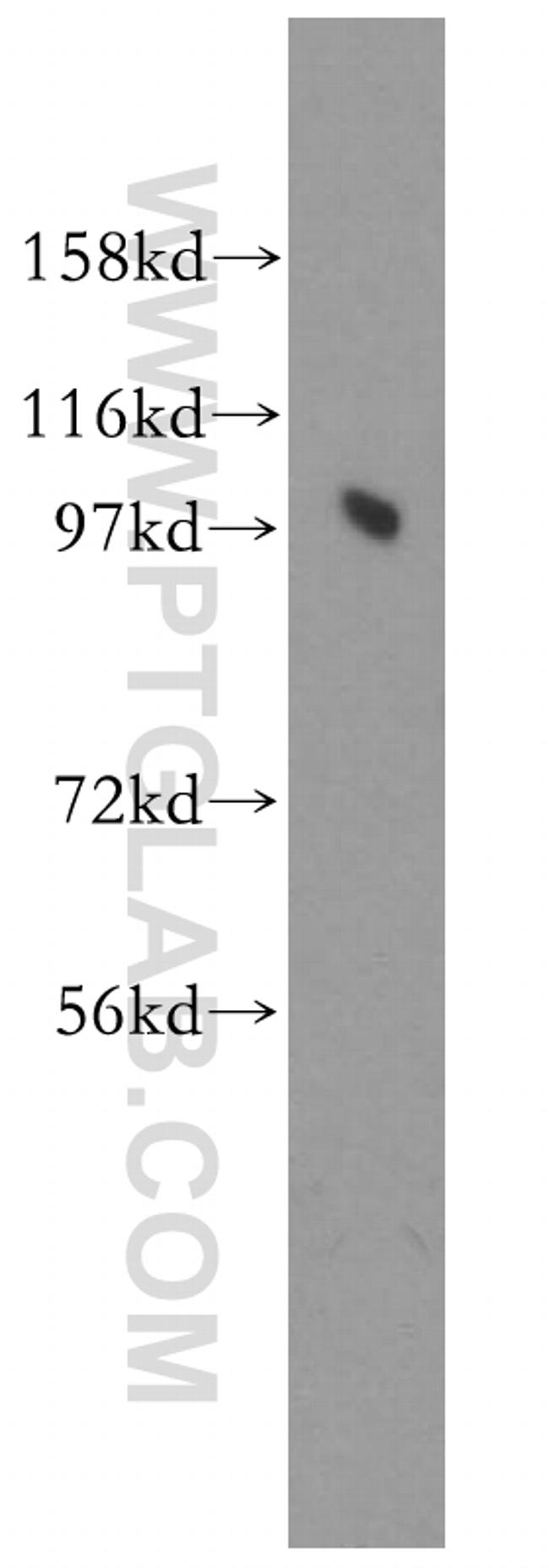 PRKD2 Antibody in Western Blot (WB)