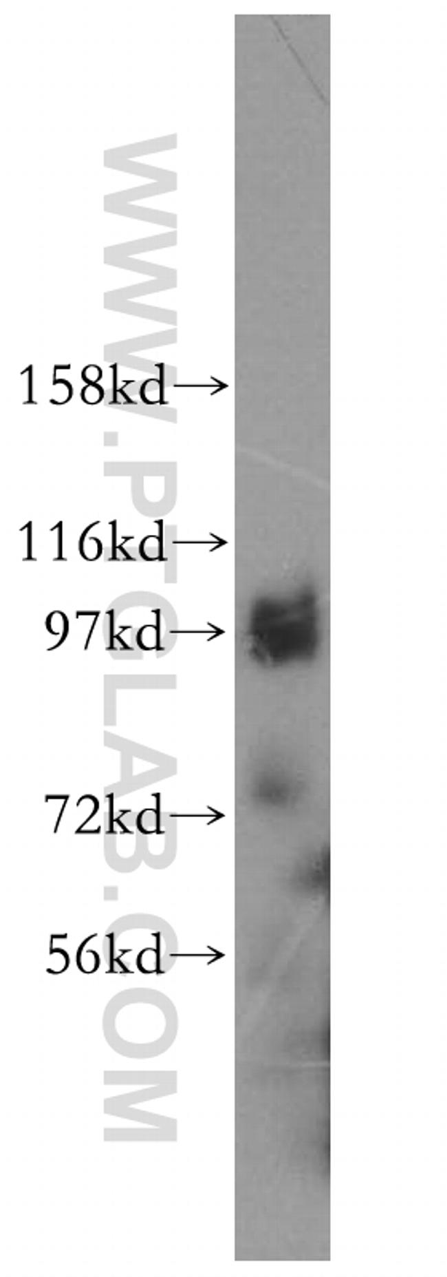 PRKD2 Antibody in Western Blot (WB)