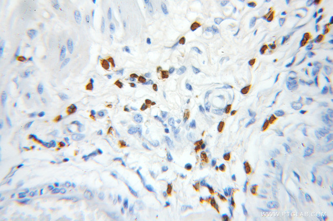 PRKD2 Antibody in Immunohistochemistry (Paraffin) (IHC (P))