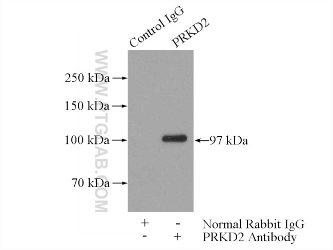 PRKD2 Antibody in Immunoprecipitation (IP)