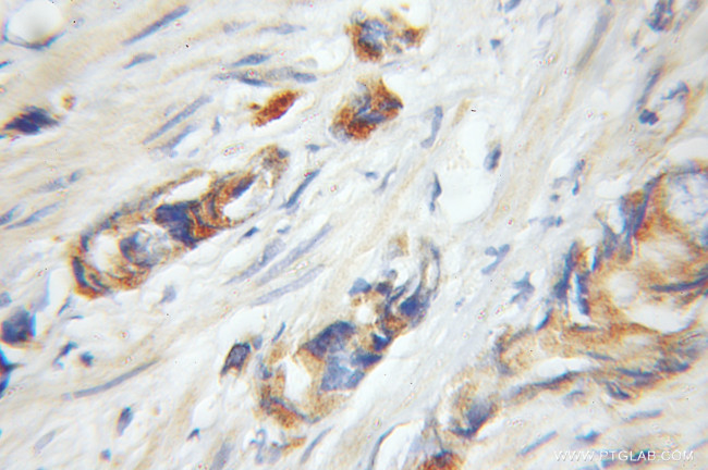 UHMK1 Antibody in Immunohistochemistry (Paraffin) (IHC (P))