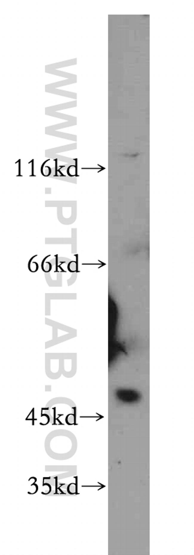 UHMK1 Antibody in Western Blot (WB)