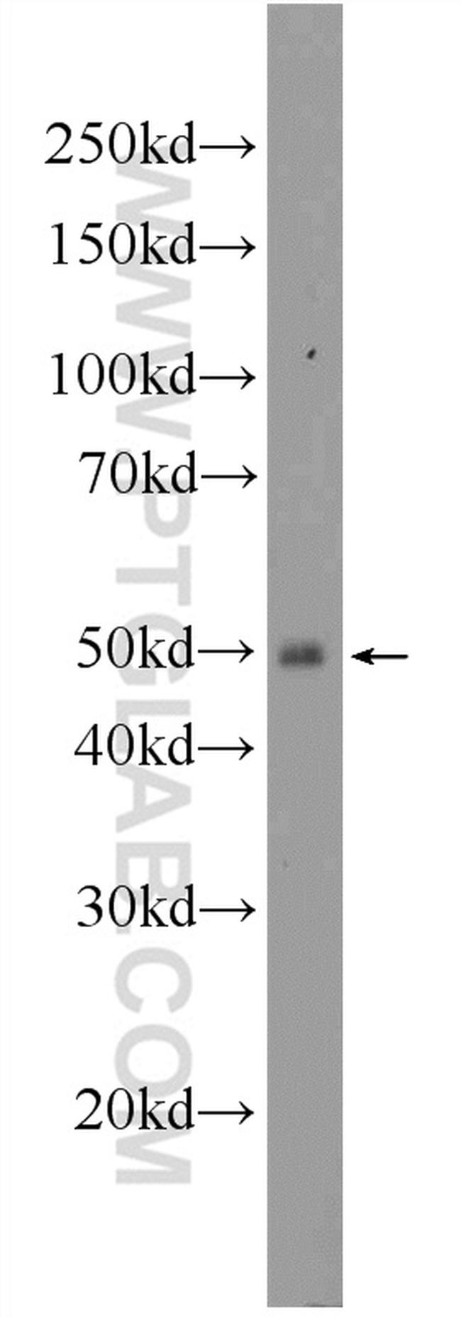 ENTPD6 Antibody in Western Blot (WB)