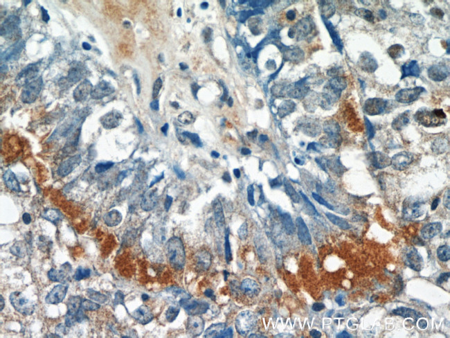 EPSTI1 Antibody in Immunohistochemistry (Paraffin) (IHC (P))