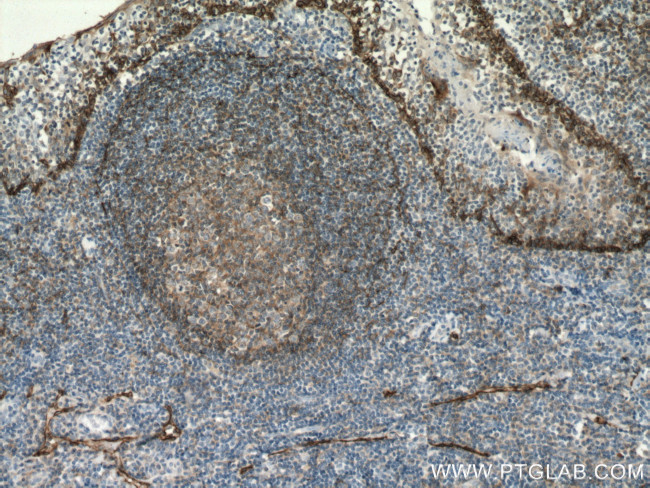 Podoplanin Antibody in Immunohistochemistry (Paraffin) (IHC (P))