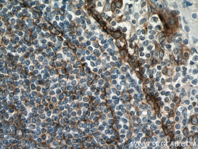 Podoplanin Antibody in Immunohistochemistry (Paraffin) (IHC (P))