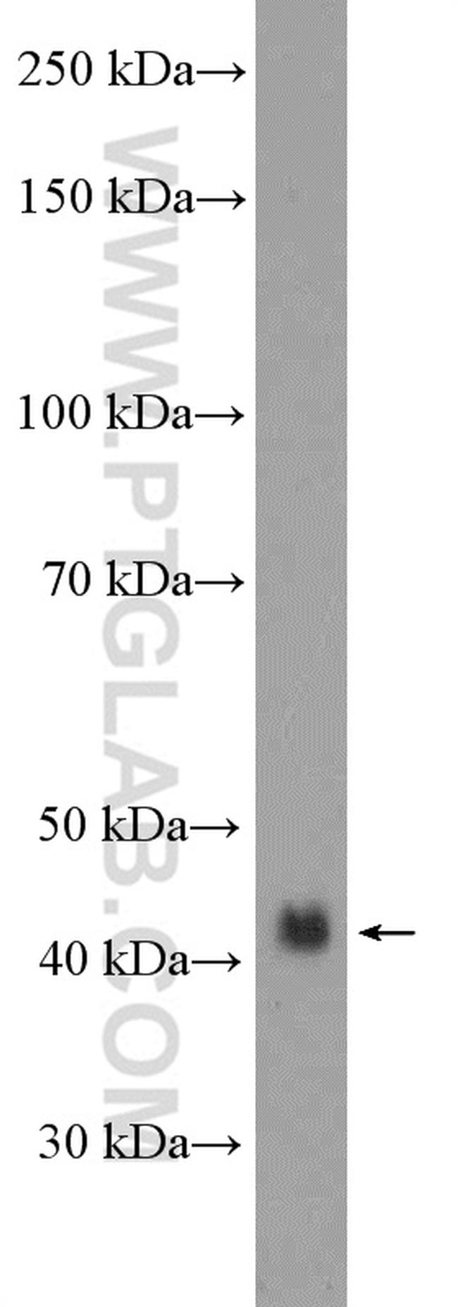 Podoplanin Antibody in Western Blot (WB)