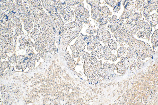 MIG6/ERRFI1 Antibody in Immunohistochemistry (Paraffin) (IHC (P))