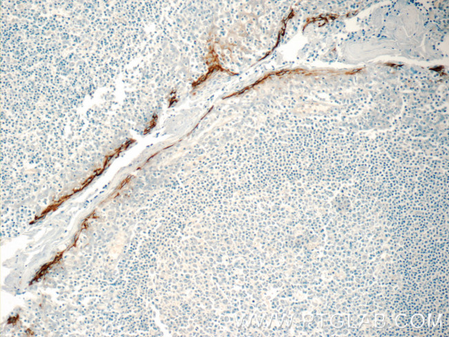 MIG6/ERRFI1 Antibody in Immunohistochemistry (Paraffin) (IHC (P))