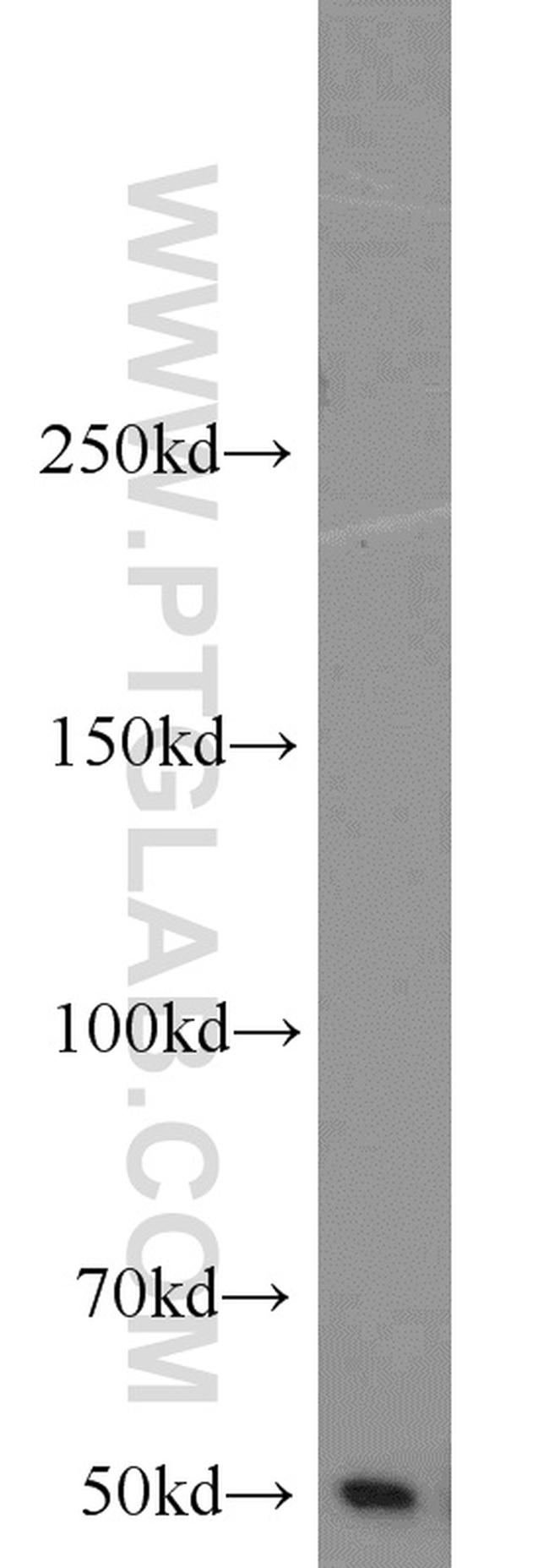 MIG6/ERRFI1 Antibody in Western Blot (WB)