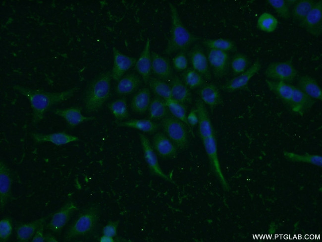 MIG6/ERRFI1 Antibody in Immunocytochemistry (ICC/IF)