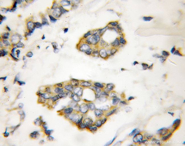 MIG6/ERRFI1 Antibody in Immunohistochemistry (Paraffin) (IHC (P))