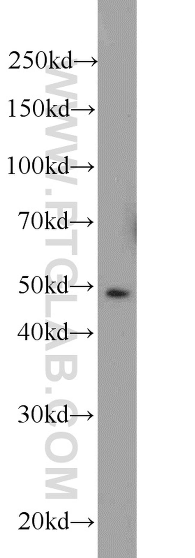 MIG6/ERRFI1 Antibody in Western Blot (WB)